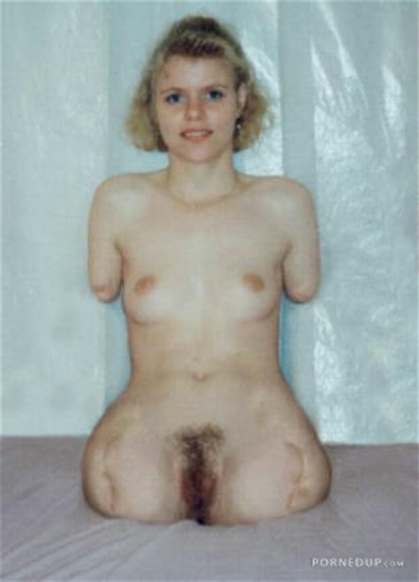 Naked Woman With No Arms And Legs Porned Up