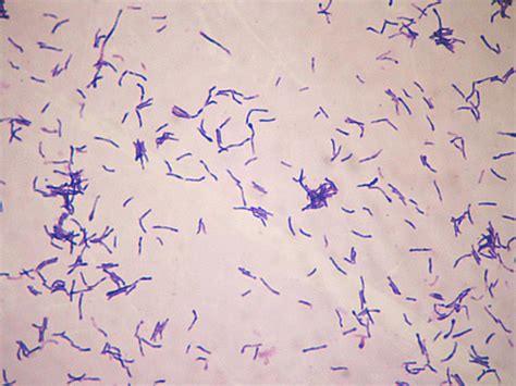Actinomyces Trueperella And Bacillus Flashcards Quizlet