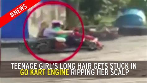 Teen Scalped In Horror Karting Accident When Her Hair Gets Caught In Go Kart Engine World News
