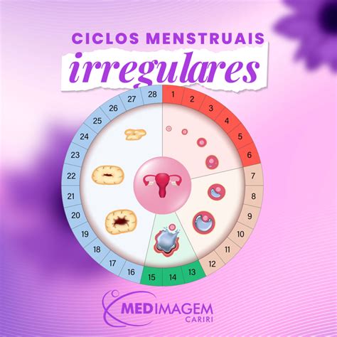 Ciclos Menstruais Irregulares Medimagem Cariri