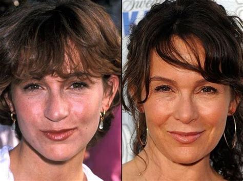 Jennifer Grey Plastic Surgery Good Nose Job Facelift Celebrity