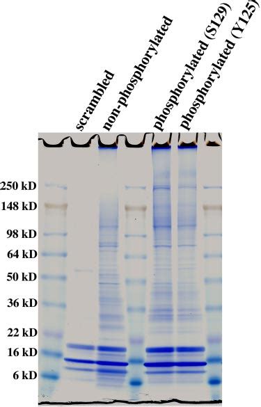 Representative Sds Page Gel Illustrating Proteins Binding To The