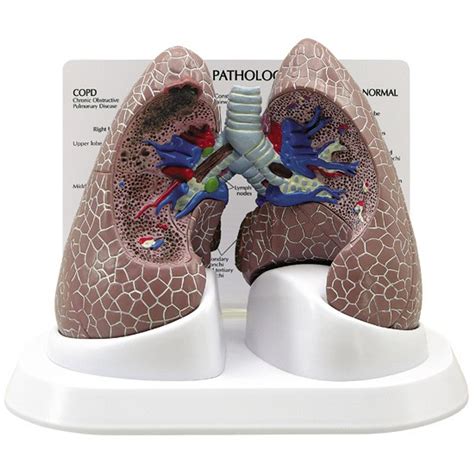 Lung And Respiratory Anatomical Models