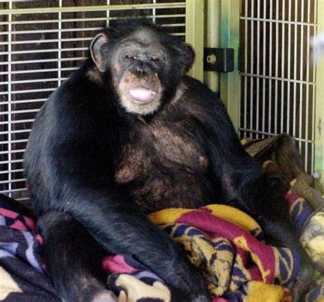 Chimpanzee Attack Victim Gets Face Transplant In Boston