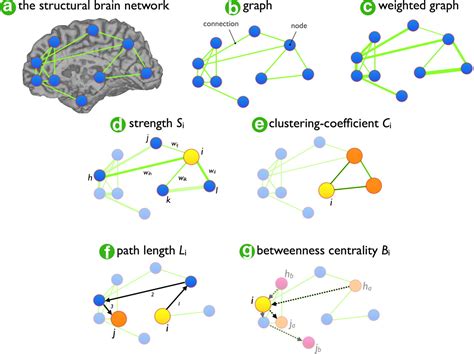 Aberrant Frontal And Temporal Complex Network Structure In