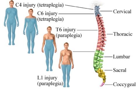 Spinal Injury Spinal Cord Injury Spinal Cord Injury