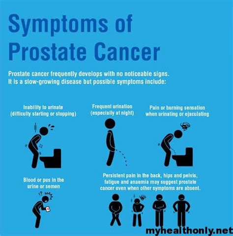 Symptoms Of Prostate Cancer Risk Factors And Causes My Health Only