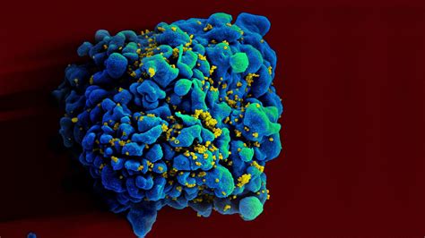 A Second Patient Has Entered Long Term Remission From Hiv Nova Pbs