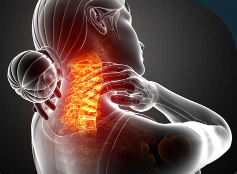 Neck Pain Treatment Spine Medicine And Surgery Of Long Island