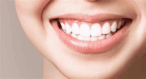 Famosos Que Usam Lentes De Contato Nos Dentes Conheça As Principais Características Das Lentes