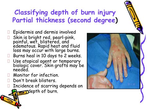 Ppt Burn Care Powerpoint Presentation Free Download Id9473856