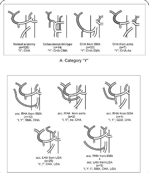 New Clinical Classification Of Anatomic Variations Of Hepatic Arteries