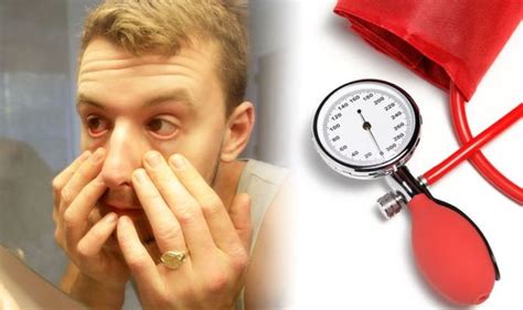 High blood pressure symptoms: Your eyes could indicate you're suffering from hypertension ...