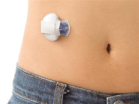 The Enlite Glucose Sensor With The Guardian Link Transmitter Attached Download Scientific