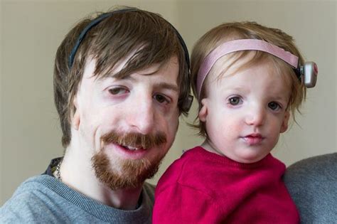 New Dad With Severe Facial Disfigurement Defends Decision To Have Baby