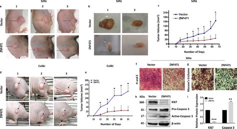 ZNF471 Inhibits Tumor Growth In Vivo In Nude Mice A Images Of Tumor
