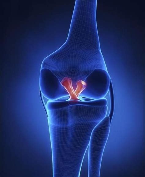 How To Improve After Acl Reconstruction Surgery Knee Ligaments Acl