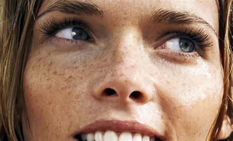 Blot Out Your Sun Spots Come Back From Holiday With Blotchy Skin Don