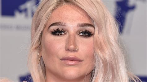 Kesha Opens Up About Eating Disorder Battle