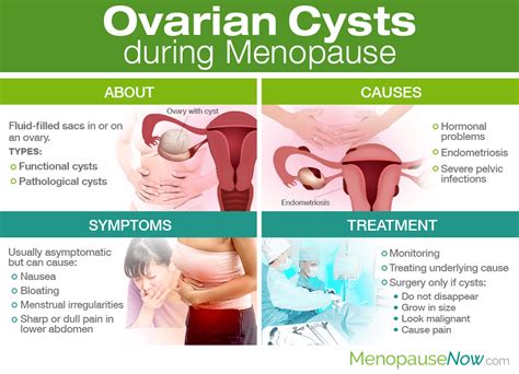 Is Ovarian Cancer More Common After Menopause Types Of Cancer That