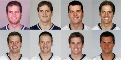 Has Tom Brady Had Work Done Plastic Surgery Twitter Thinks So