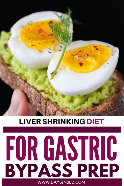 Liver Shrinking Diet For Gastric Bypass Patients Days In Bed