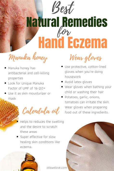 How To Use Manuka Honey For Eczema And Cure It Naturally Eczema Remedies Natural Eczema