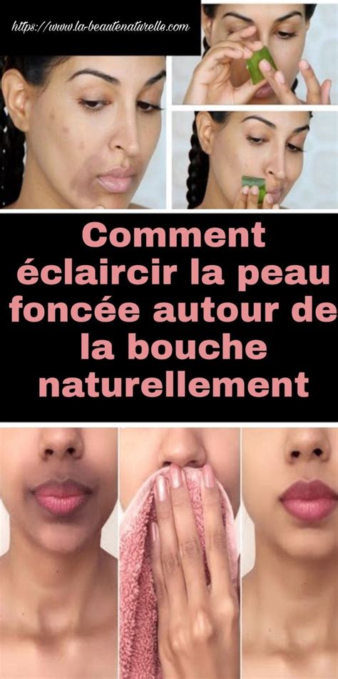 Comment éclaircir La Peau Foncée Autour De La Bouche Naturellement En