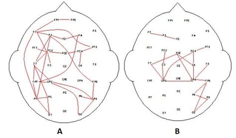 Significant Correlation Eeg Coherence Maps For Group Average Alpha Eeg