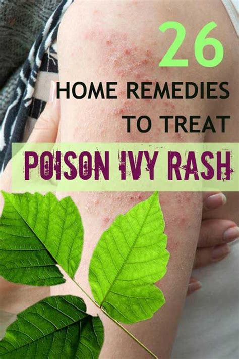 26 Home Remedies To Get Rid Of Poison Ivy Poison Ivy Home Remedies