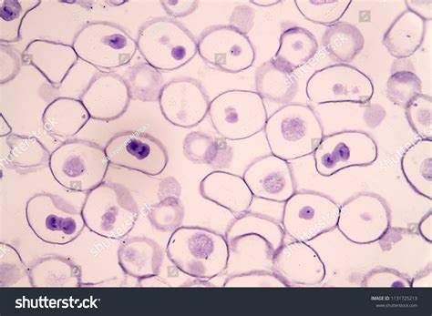 Meiosis Animal Cell Under Microscope Education Stock Fotografie