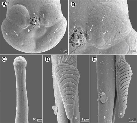 Philometra Dissimilis N Sp Scanning Electron Micrographs Of Male A