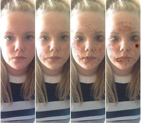 This App Shows You What Smoking Crystal Meth Would Do To Your Face