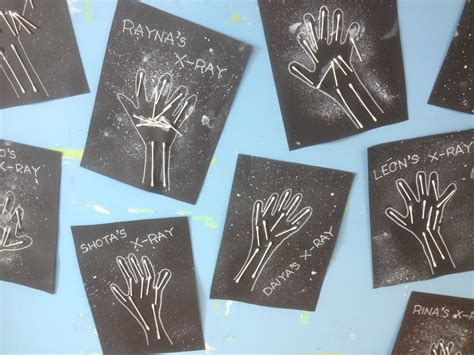 Q Tip Hand X Ray Craft Kids Put Their Hand On The Paper While