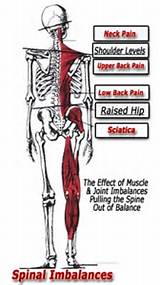 Pictures of Muscle Imbalance Exercises