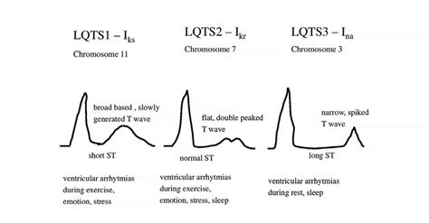 Abnormal Types Of T Waves In Lqts Lqts1 Lqts2 Lqts3 Download