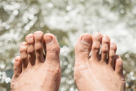 5 Tips For Preventing Athletes Foot Premier Foot And Ankle Podiatrists