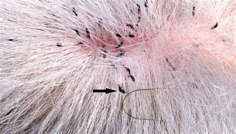 What Bugs Burrow Into Dogs Skin