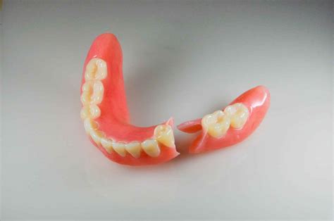 denture-repair - A Dental & Denture Seattle | Dentures | Denture ...