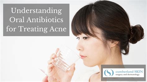 Should You Use Oral Antibiotics For Treating Acne Find Out