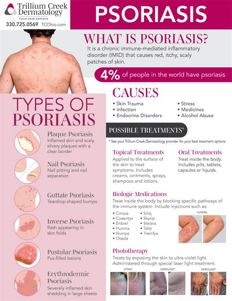 Psoriasis Treatment Near Me Psoriasis Causes Ohio