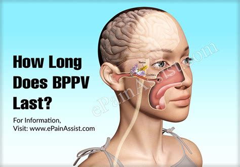 Imagine a hill with blades of grass, and on top of each blade is a crystal, explains dr. How Long Does BPPV Last & What are its Best Home ...