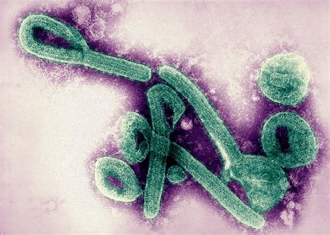 Este animal lo transmite a las personas y estas pueden. Mysterious Hemorrhagic Fever Outbreak Stumps Disease ...