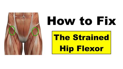 Hip Flexor Pain Causes