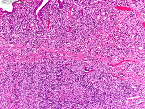 A Collection Of Surgical Pathology Images