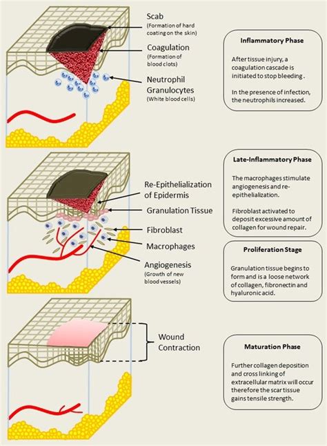 Diagram Body Diagram Wound Healing Mydiagramonline