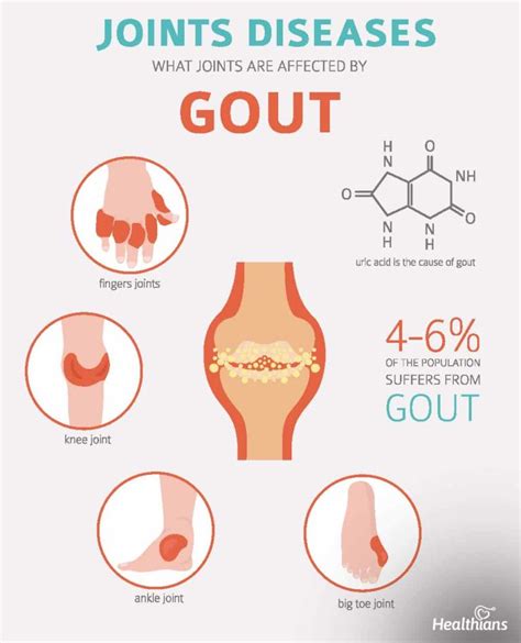 Gout Signs Symptoms Healthians Blog