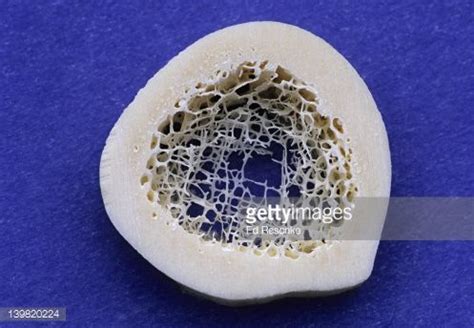 We can use the collisional cross section to find how large the distance between two particles must be in order for a collision to occur. Compact & spongy bone. Cross section of a long bone. Shows ...