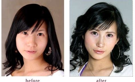 Plastic Surgery In Japan