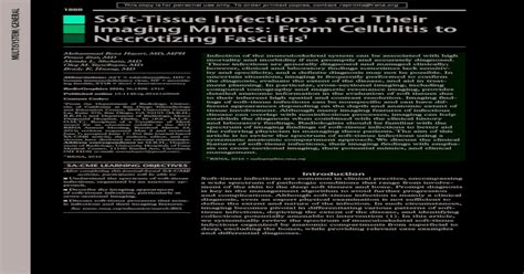 1888 Soft Tissue Infections And Their Imaging Mimics From Soft
